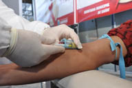 Teste de HIV é uma importante ferramenta para o controle da Aids