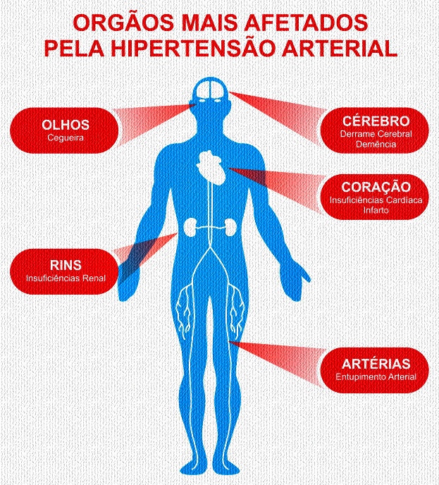 Hipertens O Arterial Seis Coisas Para Voc Saber Sobre A Doen A Contexto