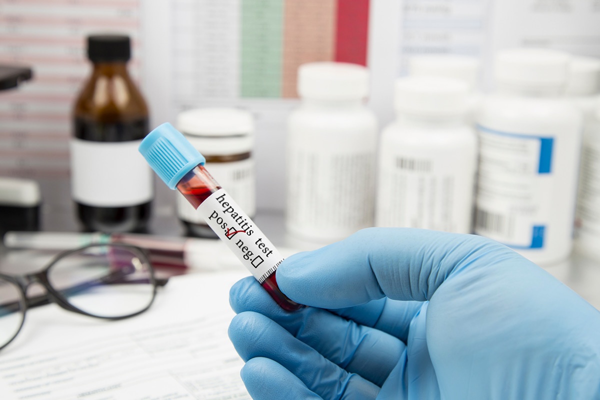 Contexto Oms Confirma Mais De 100 Casos De Hepatite De Origem Desconhecida 5274