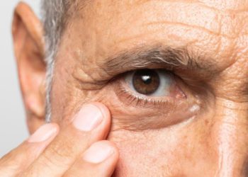 foto de idoso evidenciando olho com glaucoma