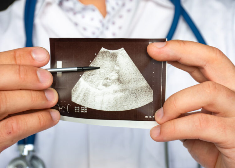 foto de médico mostrando raio x do fígado, órgão que é afetado pela hepatite