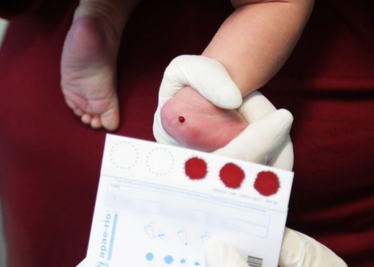 foto do teste do pezinho sendo realizado em bebê