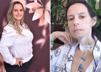 Ana Paula da Costa Santana passou da obesidade para anemia extrema após fazer cirurgia barátrica — Foto: Arquivo pessoal