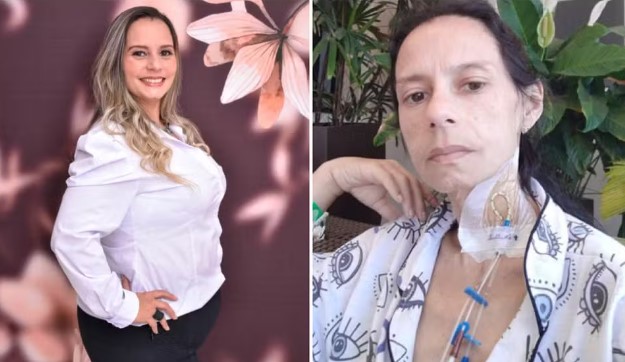 Ana Paula da Costa Santana passou da obesidade para anemia extrema após fazer cirurgia barátrica — Foto: Arquivo pessoal