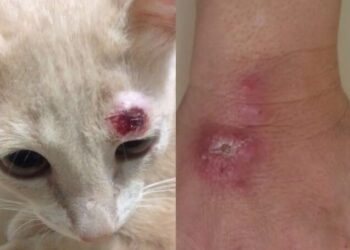 A transmissão ocorre principalmente pelo contato com feridas de animais contaminados. Imagem: Reprodução