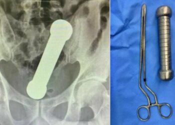 Imagem: Reprodução | Science Direct