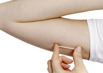 Foto: AP/Merck, File