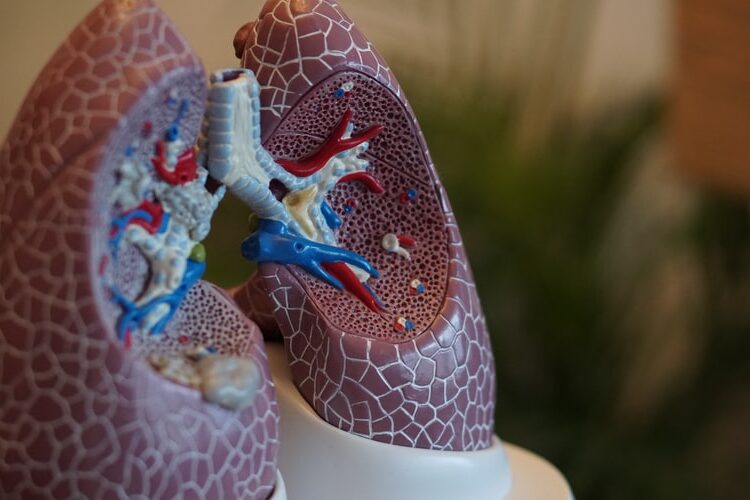 Fibrose cística é uma condição crônica que prejudica pulmões, pâncreas e sistema digestivo. Iagem: Reprodução