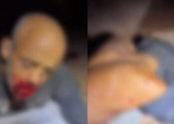 Homem fica ferido após ser esfaqueado pelas costas pelo próprio filho em Anápolis (Foto: Reprodução)