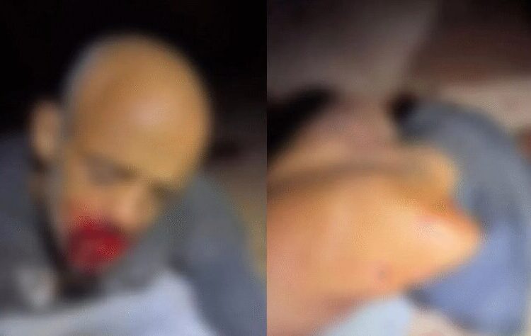 Homem fica ferido após ser esfaqueado pelas costas pelo próprio filho em Anápolis (Foto: Reprodução)