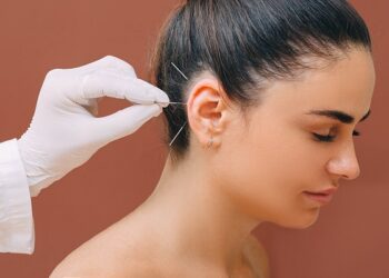 Acupuncturist treats a patients illness with acupuncture at special points on her ear. Acupuncture - alternative medicine
