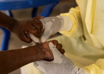 Foto: REUTERS/Arlette Bashizi