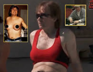 Brian Zembic cumpriu desafio inusitado e manteve implantes por anos. Imagem: Reprodução