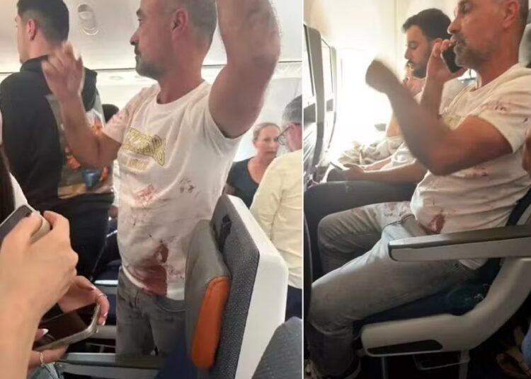 Passageiro com sangue na camisa após incidente em que copiloto esfaqueou o piloto durante voo de Dubai a Tel Aviv, segundo emissora israelense — Foto: Reprodução/X